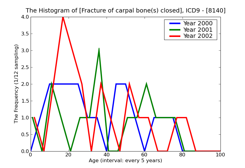 ICD9 Histogram Fracture of carpal bone(s) closed