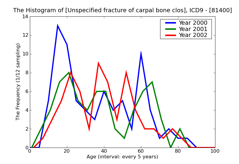 ICD9 Histogram Unspecified fracture of carpal bone closed