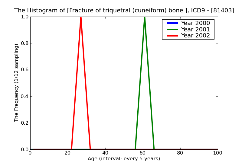 ICD9 Histogram Fracture of triquetral (cuneiform) bone of wrist closed