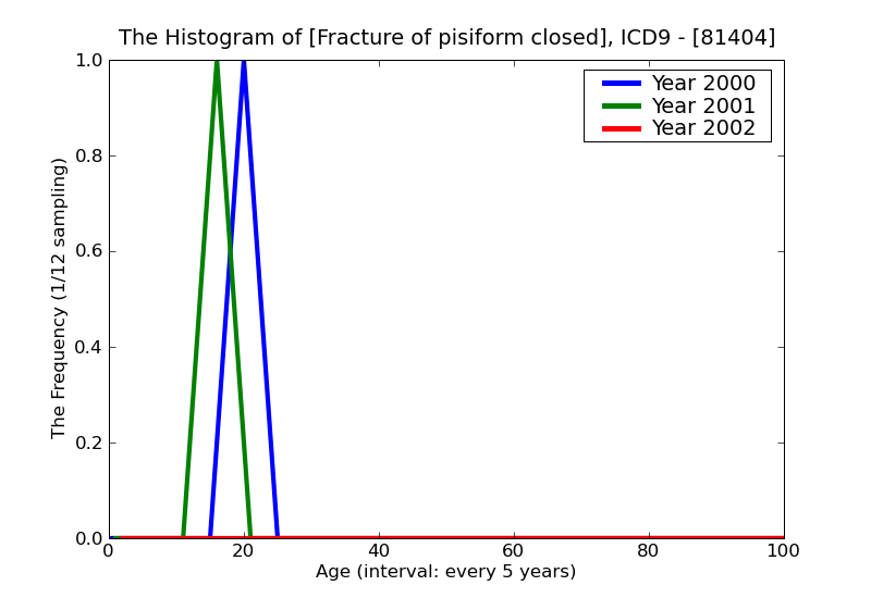 ICD9 Histogram Fracture of pisiform closed