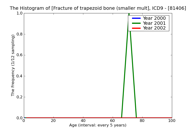 ICD9 Histogram Fracture of trapezoid bone (smaller multangular) closed
