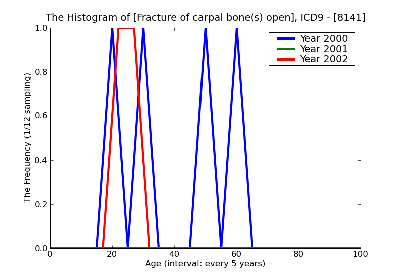 ICD9 Histogram Fracture of carpal bone(s) open