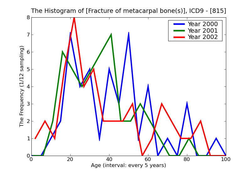 ICD9 Histogram Fracture of metacarpal bone(s)