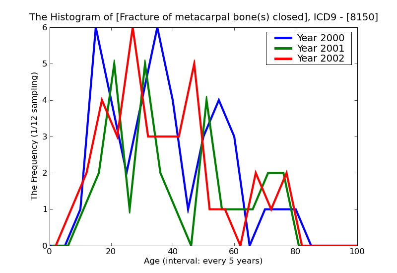 ICD9 Histogram Fracture of metacarpal bone(s) closed