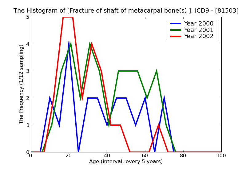 ICD9 Histogram Fracture of shaft of metacarpal bone(s) closed