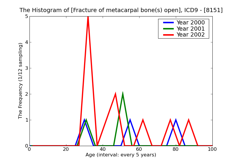 ICD9 Histogram Fracture of metacarpal bone(s) open
