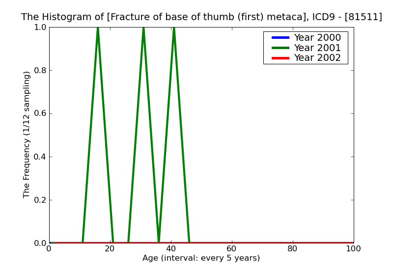 ICD9 Histogram Fracture of base of thumb (first) metacarpal open