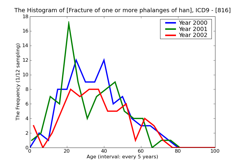 ICD9 Histogram Fracture of one or more phalanges of hand
