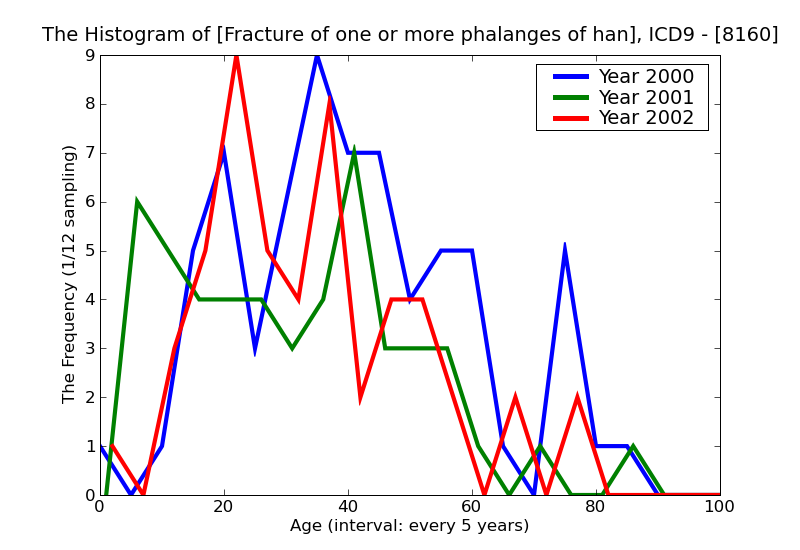 ICD9 Histogram Fracture of one or more phalanges of hand closed