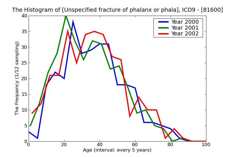 ICD9 Histogram Unspecified fracture of phalanx or phalanges closed