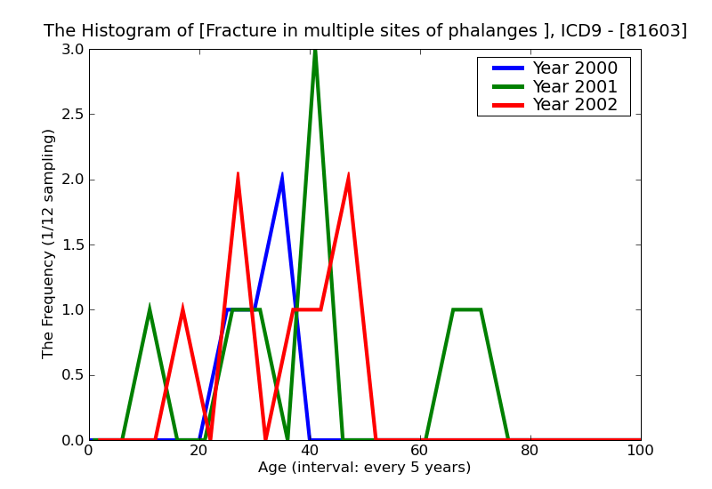 ICD9 Histogram Fracture in multiple sites of phalanges closed