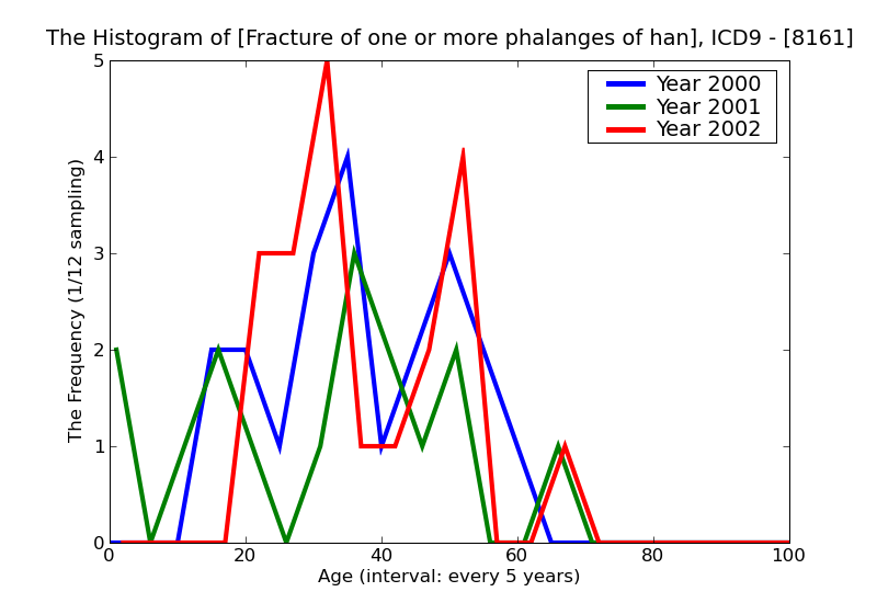 ICD9 Histogram Fracture of one or more phalanges of hand open