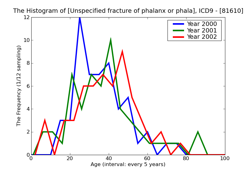 ICD9 Histogram Unspecified fracture of phalanx or phalanges open
