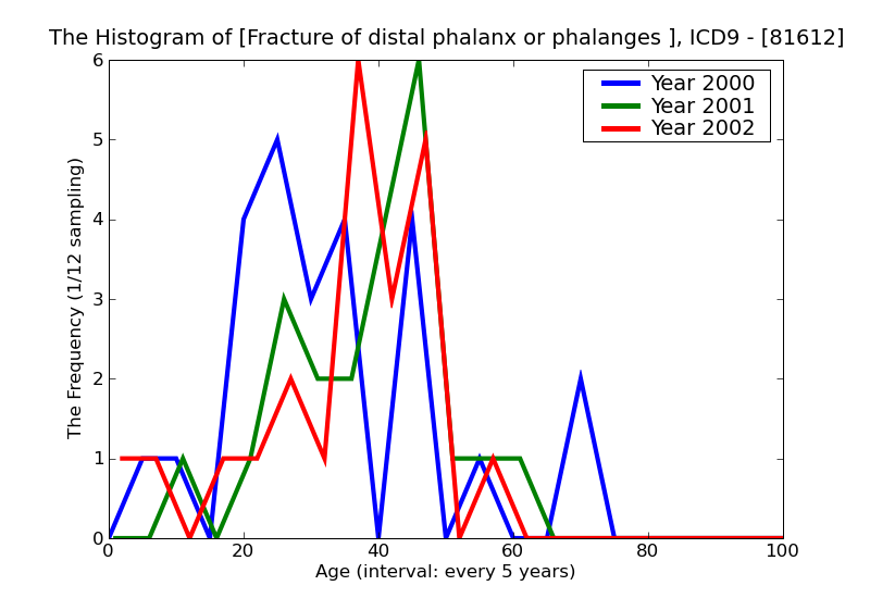 ICD9 Histogram Fracture of distal phalanx or phalanges open