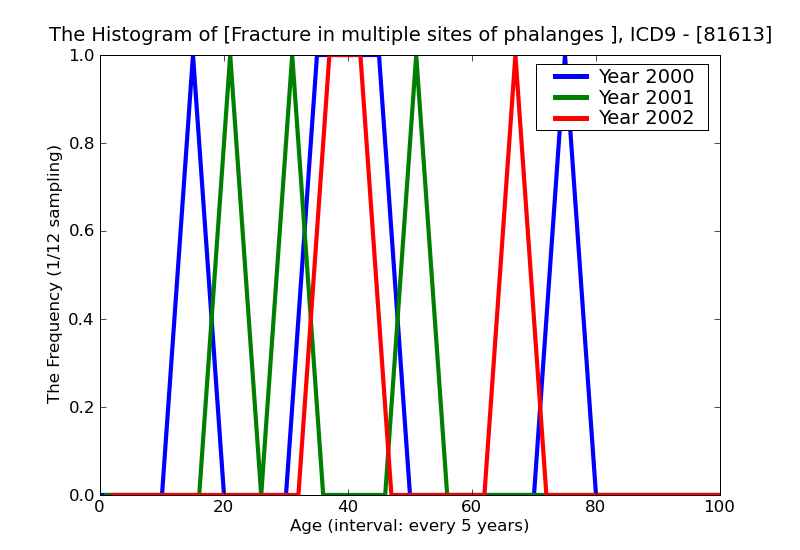 ICD9 Histogram Fracture in multiple sites of phalanges open