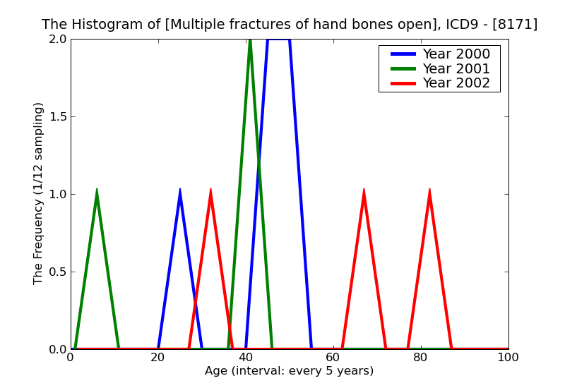ICD9 Histogram Multiple fractures of hand bones open