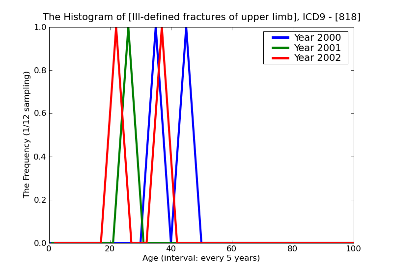 ICD9 Histogram Ill-defined fractures of upper limb