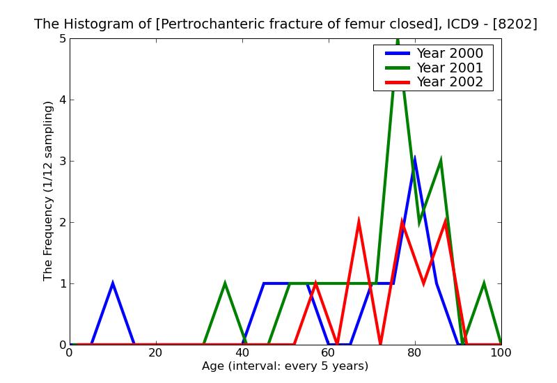 ICD9 Histogram Pertrochanteric fracture of femur closed