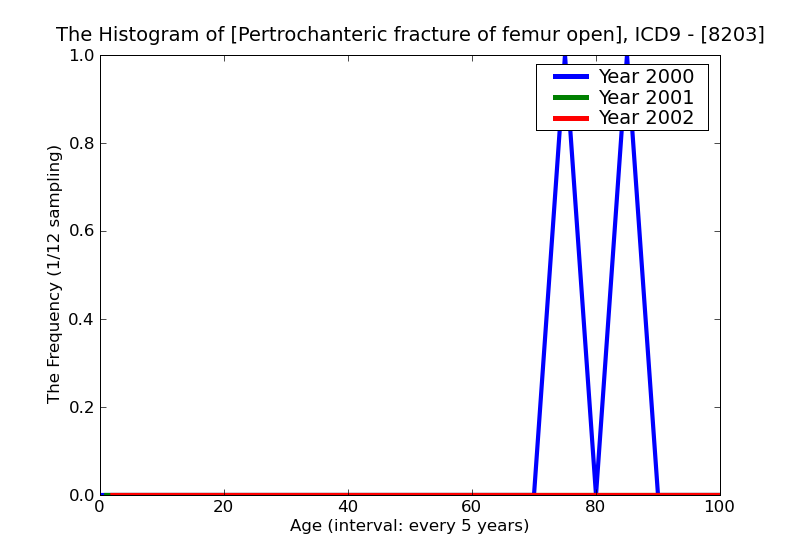ICD9 Histogram Pertrochanteric fracture of femur open