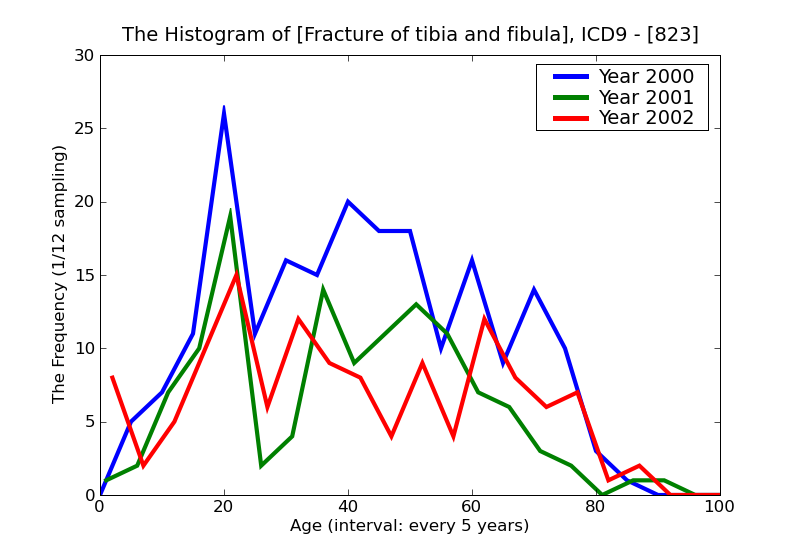 ICD9 Histogram Fracture of tibia and fibula