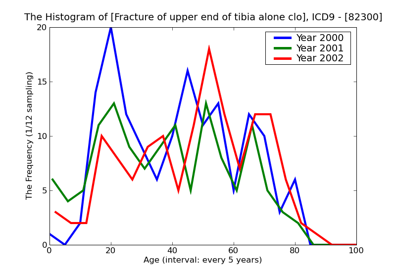ICD9 Histogram Fracture of upper end of tibia alone closed