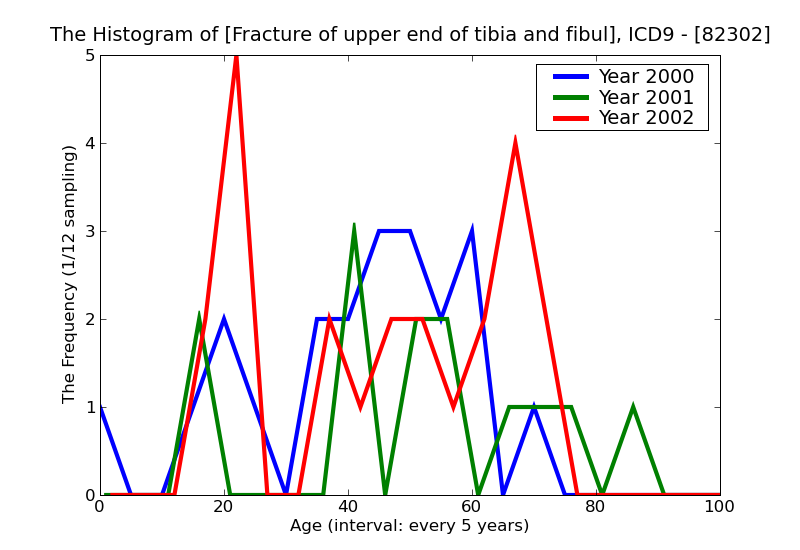 ICD9 Histogram Fracture of upper end of tibia and fibula closed