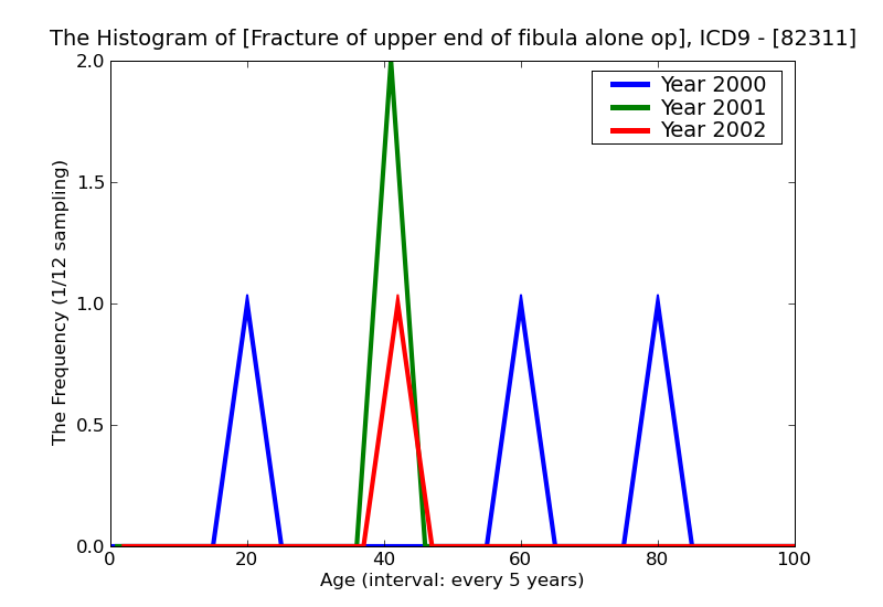 ICD9 Histogram Fracture of upper end of fibula alone open