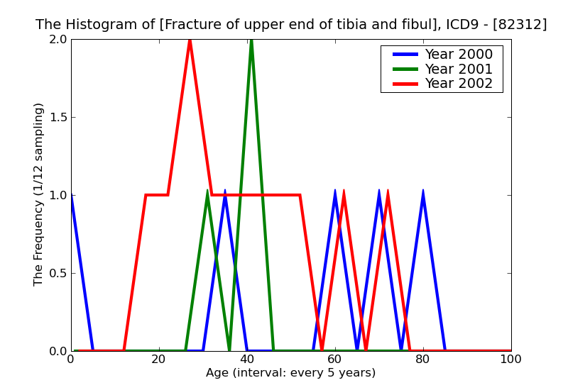 ICD9 Histogram Fracture of upper end of tibia and fibula open