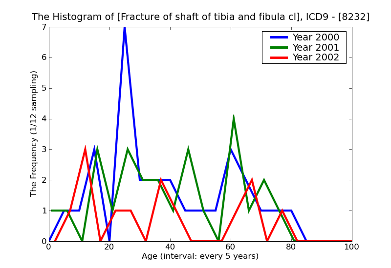ICD9 Histogram Fracture of shaft of tibia and fibula closed