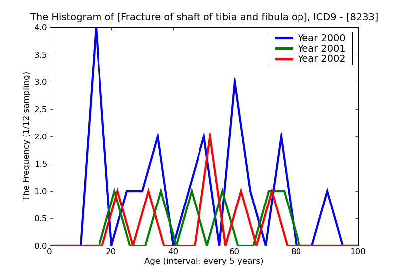 ICD9 Histogram Fracture of shaft of tibia and fibula open