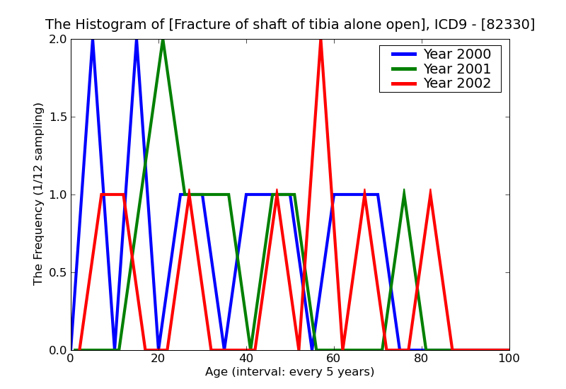 ICD9 Histogram Fracture of shaft of tibia alone open