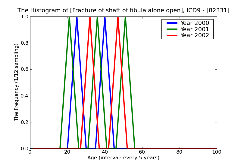 ICD9 Histogram Fracture of shaft of fibula alone open