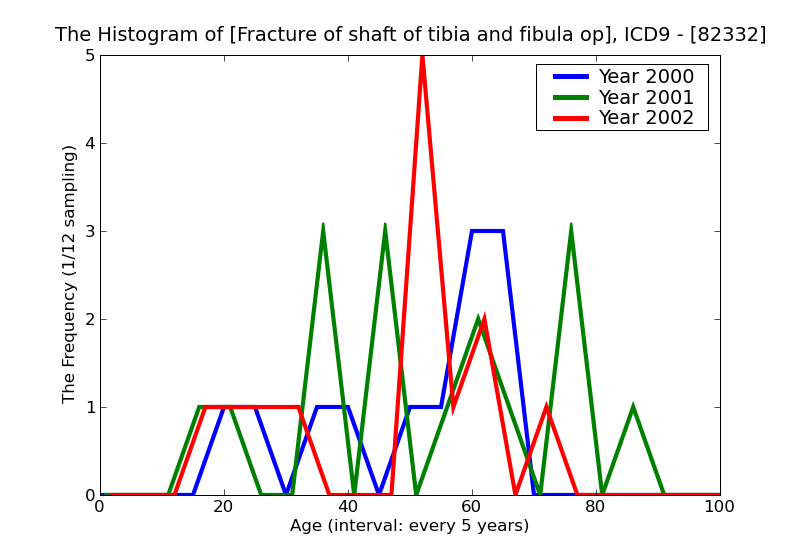 ICD9 Histogram Fracture of shaft of tibia and fibula open