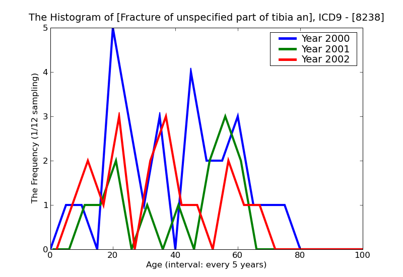 ICD9 Histogram Fracture of unspecified part of tibia and fibula closed