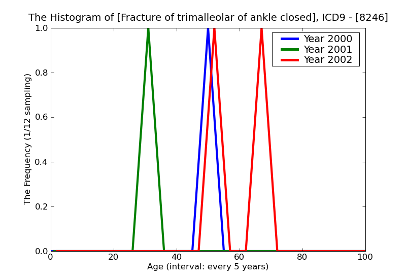 ICD9 Histogram Fracture of trimalleolar of ankle closed