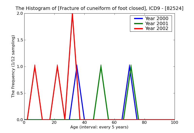 ICD9 Histogram Fracture of cuneiform of foot closed