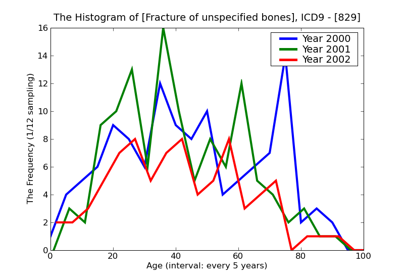 ICD9 Histogram Fracture of unspecified bones