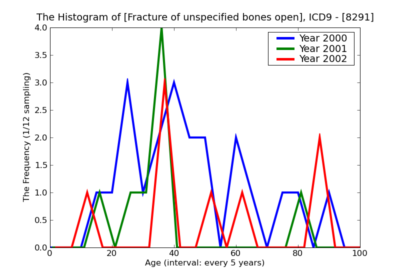 ICD9 Histogram Fracture of unspecified bones open