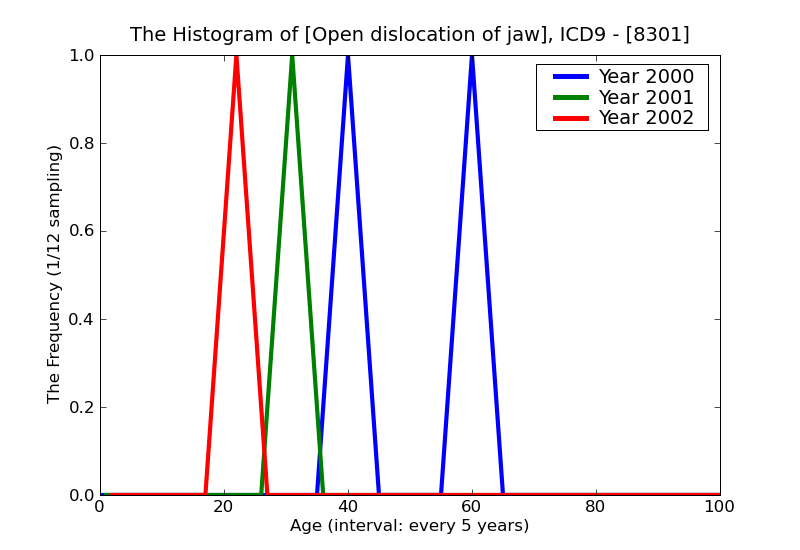 ICD9 Histogram Open dislocation of jaw