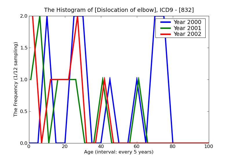 ICD9 Histogram Dislocation of elbow