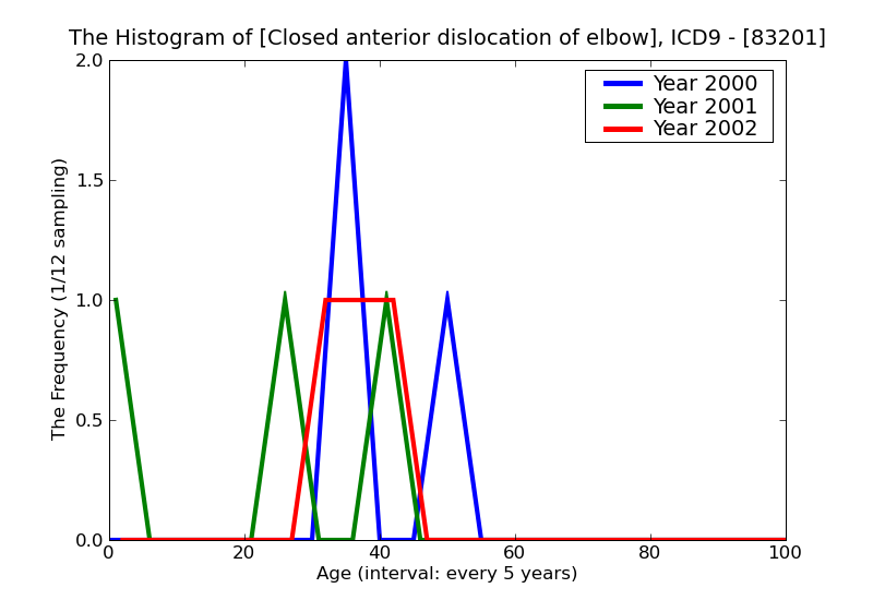 ICD9 Histogram Closed anterior dislocation of elbow