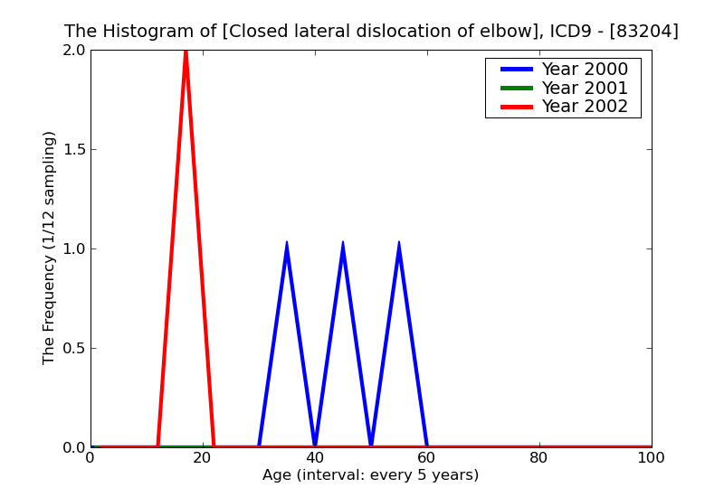 ICD9 Histogram Closed lateral dislocation of elbow