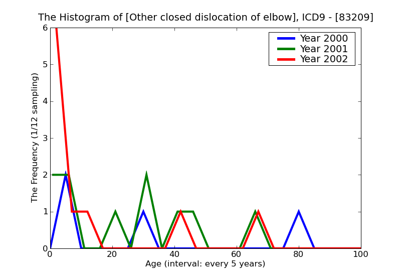 ICD9 Histogram Other closed dislocation of elbow