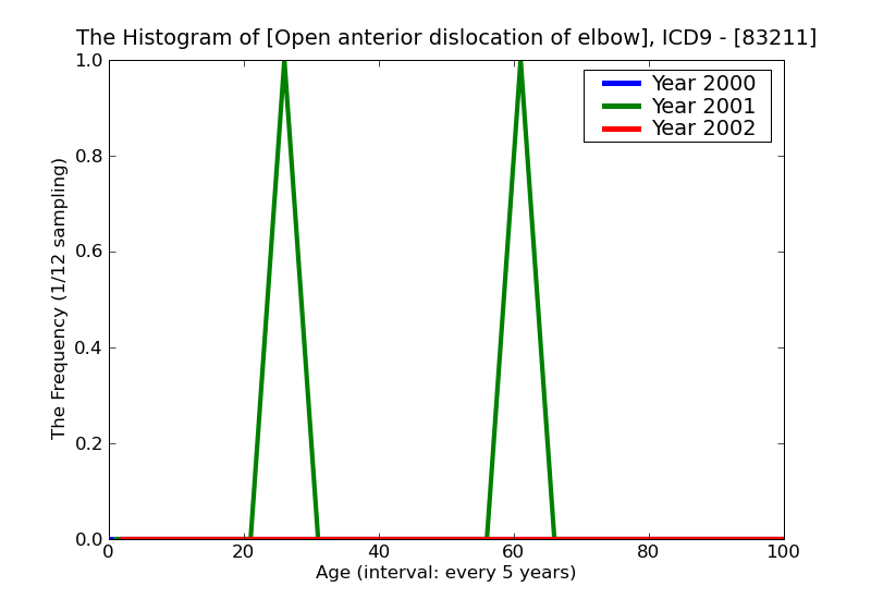 ICD9 Histogram Open anterior dislocation of elbow