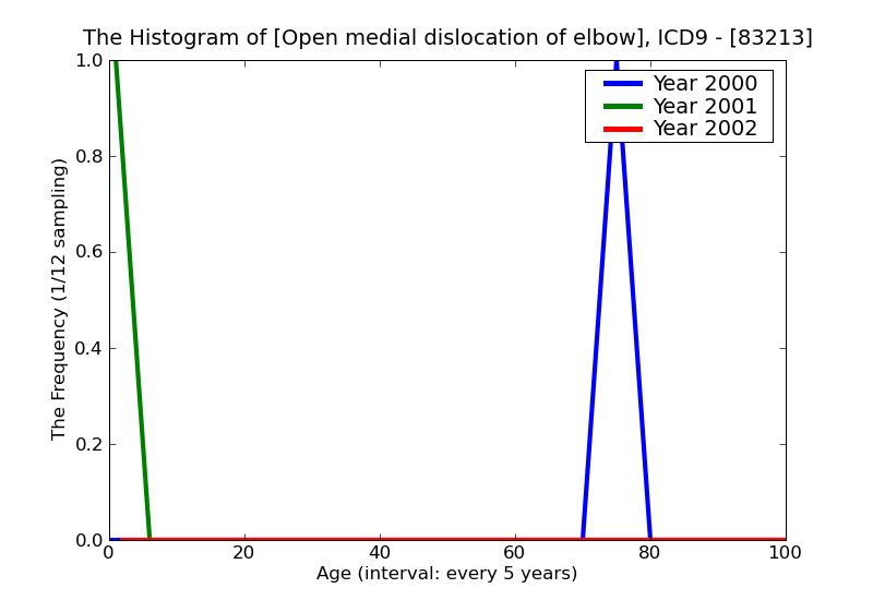 ICD9 Histogram Open medial dislocation of elbow