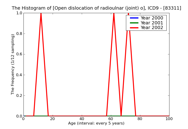 ICD9 Histogram Open dislocation of radioulnar (joint) of distal