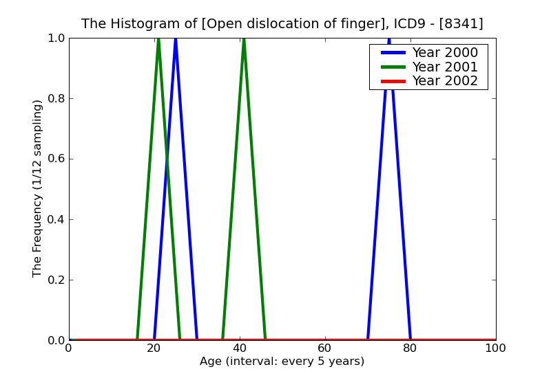 ICD9 Histogram Open dislocation of finger