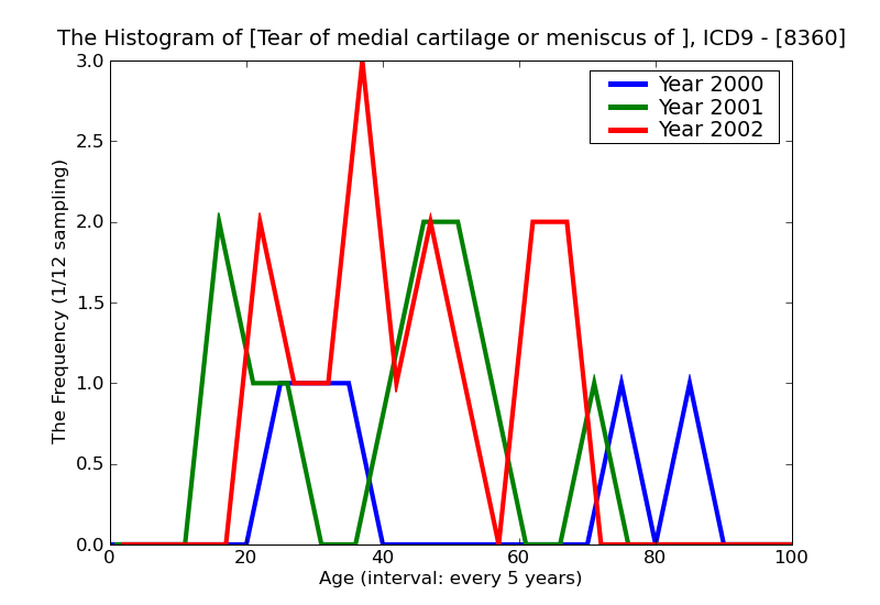 ICD9 Histogram Tear of medial cartilage or meniscus of knee current