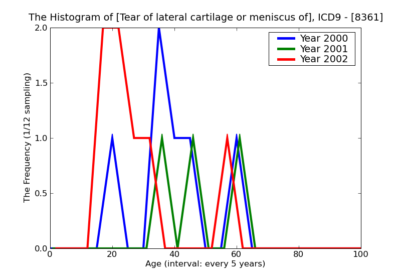 ICD9 Histogram Tear of lateral cartilage or meniscus of knee current