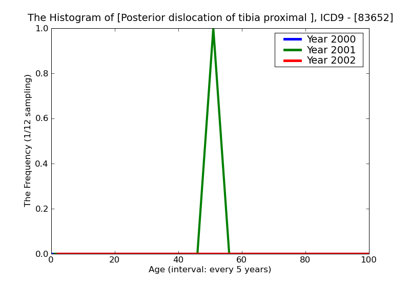 ICD9 Histogram Posterior dislocation of tibia proximal end closed